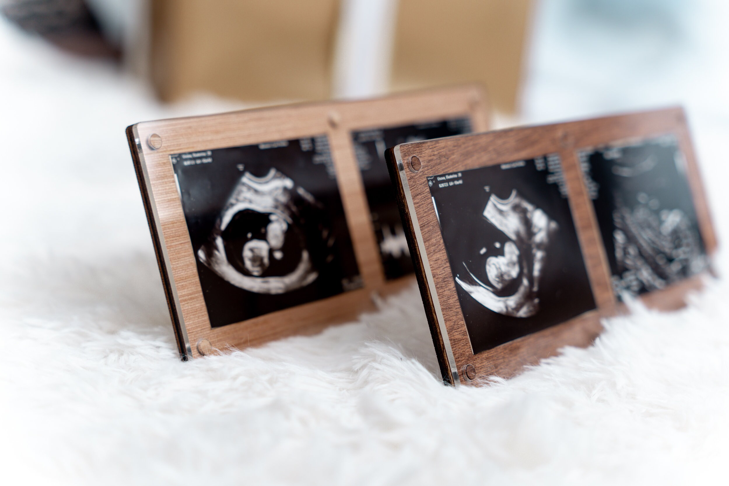 Products Ultrasound Frame for 2 ultrasound pictures sonogram frame