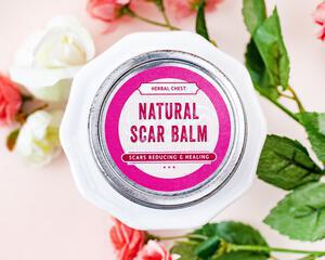 Scar Balm Stretch Marks, Acne, Surgery Scar Cream, Natural Healing 2oz tin