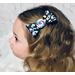 My year old modeling the Black glitter with bright neon cheetah print on top. Topped w/ neon candy resin charm.